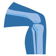 Joint and Bone Health