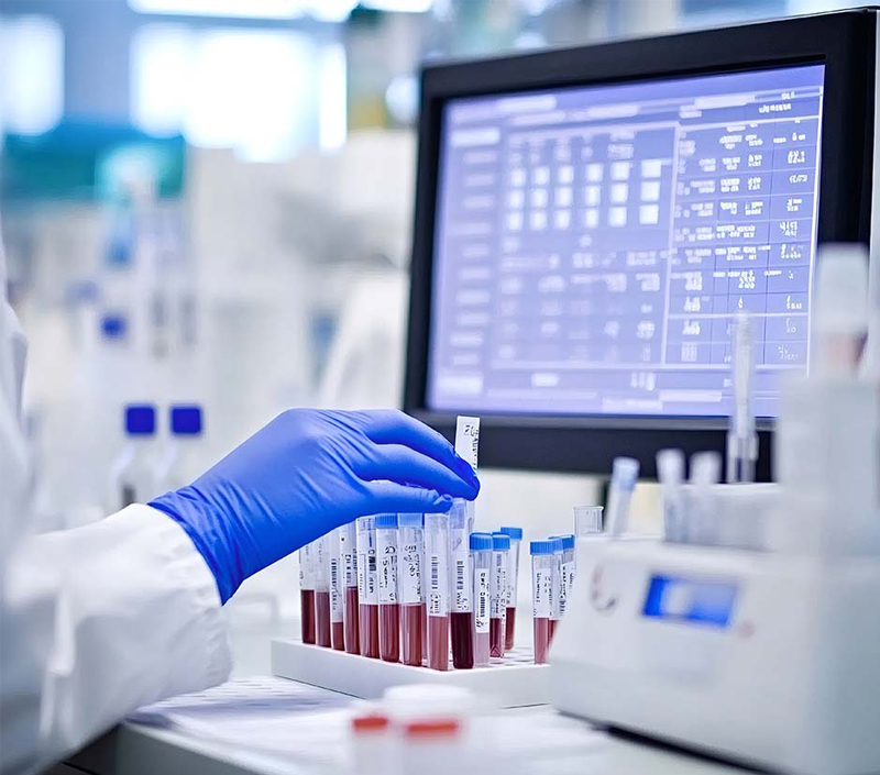 Iron Bioavailability in Anemia Recovery