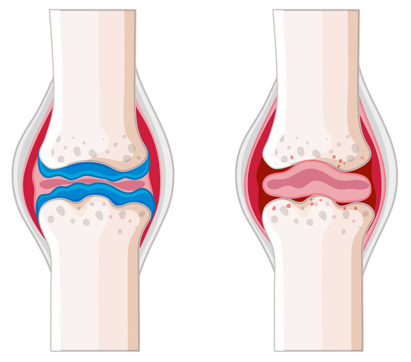 ​Promotes Bone and Cardiovascular Health